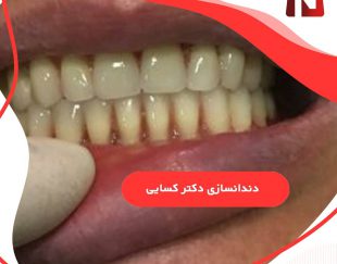 دندانسازی دکتر کسایی