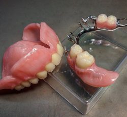 دندانسازی و دندانپزشکی و دندان مصنوعی کرمان