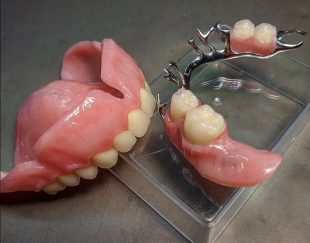دندانسازی و دندانپزشکی و دندان مصنوعی کرمان
