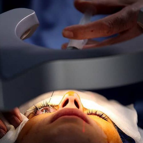 مرکز فوق تخصصی خصوصی لازک PRK چشم، حذف دائمی عینک