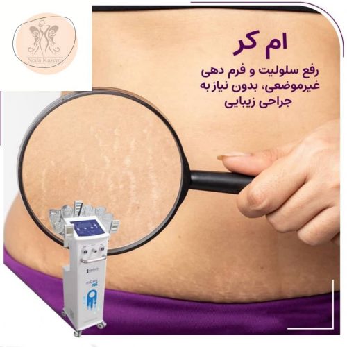 کلینیک تغذیه و رژیم درمانی_مجهز به پیشرفته ترین دستگاه های لاغری موضعی در کرج