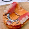ساخت انواع دندان مصنوعی در تهران