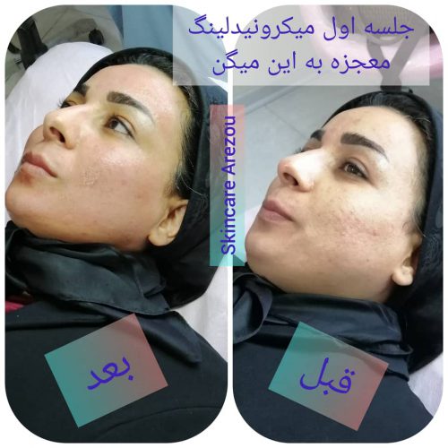 آموزش پاکسازی تخصصی پوست (فیشیال)  در اهواز