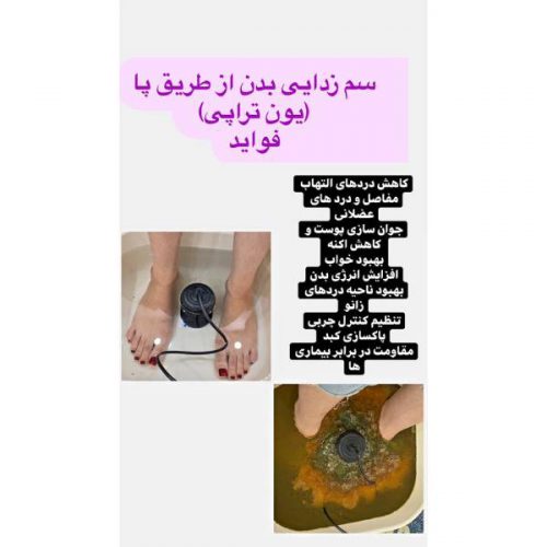 سم زدایی بدن از طریق پا به وسیله دستگاه یون تراپی در کرمان