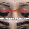 کاشت مو تخصصی جردن شیراز