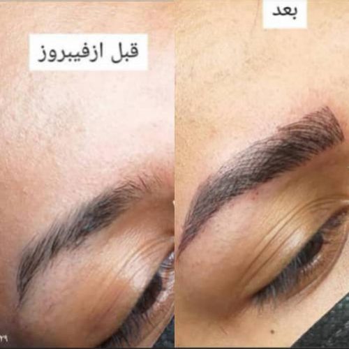 ارائه خدمات آرایشی صورت در کرمان