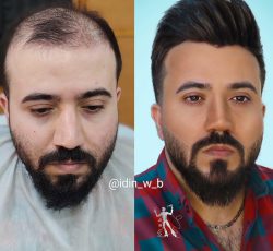 ارتقاء سطح وخدمات آرایشگری مردانه در تهران
