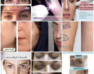عمل های زیبایی و پوست درمانی در شیراز