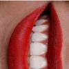 خدمات دندانپزشکی / کامپوزیت / اصلاح طرح لبخند / ایمپلنت / ارتودنسی در تهران – فلاح