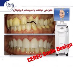 کلینیک جراحی زیبایی و پیکر تراشی و دندانپزشکی دیجیتال لیزری پردیس در تهران – پاسداران