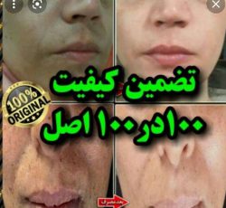 مرکز فروش کرم ضد لک و روشن کننده پوست در بوشهر و سراسر کشور