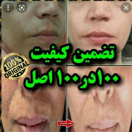 مرکز فروش کرم ضد لک و روشن کننده پوست در بوشهر و سراسر کشور