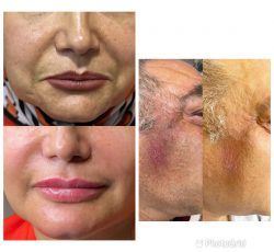 کلینیک تخصصی پوست و زیبایی و لیزر هانیل در کرج