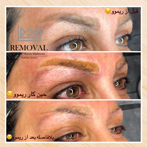 بهترین مرکز انجام خدمات و آموزش آرایش دائم و ریموو تاتو در شیراز
