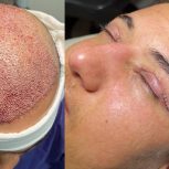 بزرگ ترین کلینیک پوست و مو و جراحی محدود در سعادت آباد